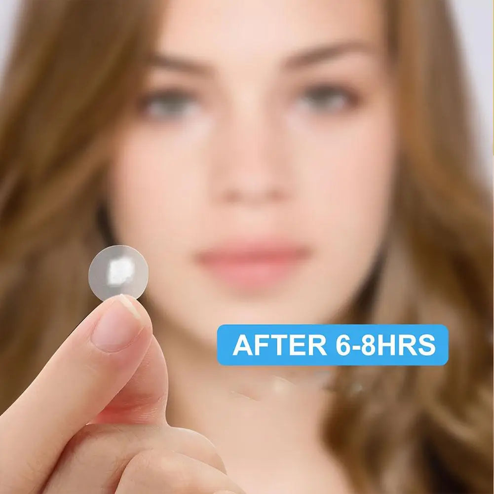 ✨ Acne Pimple Patches – 360pcs/180pcs, Circle, Star & Heart Shapes – Clear Skin Healing Patch